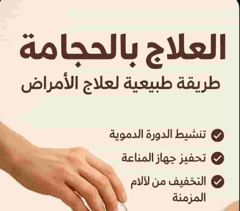 أخصائي حجامة